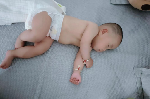 大理孕妇前庭大腺囊肿